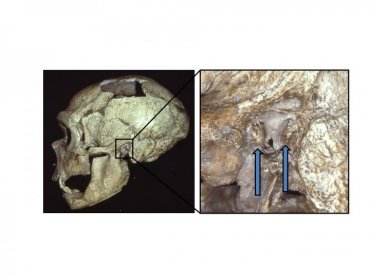 Неандертальцы часто страдали «ухом серфингиста»